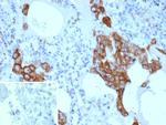 Mannose Receptor/CD206 (Marker of M2 Macrophages) Antibody in Immunohistochemistry (Paraffin) (IHC (P))