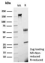 Mannose Receptor/CD206 (Marker of M2 Macrophages) Antibody in SDS-PAGE (SDS-PAGE)