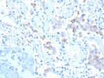 Mannose Receptor/CD206 Antibody in Immunohistochemistry (Paraffin) (IHC (P))