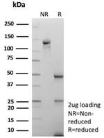 Mannose Receptor/CD206 Antibody in SDS-PAGE (SDS-PAGE)