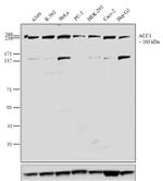 Acetyl-CoA Carboxylase Monoclonal Antibody (143)