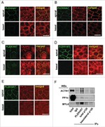 PP1 alpha Antibody in Western Blot (WB)