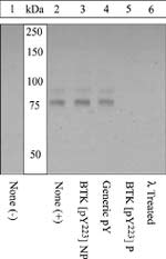 Phospho-Btk (Tyr223) Polyclonal Antibody