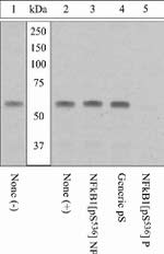 Phospho-NFkB p65 (Ser536) Antibody in Western Blot (WB)