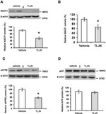 beta Amyloid Antibody in Western Blot (WB)
