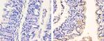 Phospho-PDGFRA (Tyr754) Polyclonal Antibody