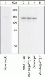 Phospho-Vinculin (Tyr822) Antibody in Western Blot (WB)