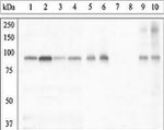 Phospho-GYS1 (Ser641, Ser645) Antibody in Western Blot (WB)