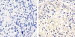 Phospho-FGFR1 (Tyr653, Tyr654) Polyclonal Antibody