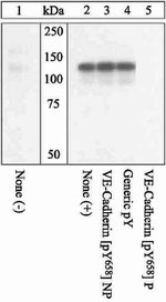 Phospho-VE-cadherin (Tyr658) Polyclonal Antibody