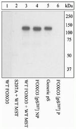 Phospho-FOXO1/FOXO3 (Ser207, Ser212) Polyclonal Antibody