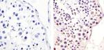 Phospho-MDM2 (Ser166) Antibody in Immunohistochemistry (Paraffin) (IHC (P))
