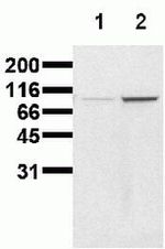 Phospho-beta Catenin (Ser86) Antibody in Western Blot (WB)