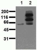 Phospho-beta Catenin (Tyr654, Tyr643) Antibody in Western Blot (WB)