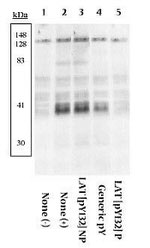 Phospho-LAT (Tyr132) Antibody in Western Blot (WB)
