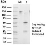 FOXB2 (Transcription Factor) Antibody in SDS-PAGE (SDS-PAGE)