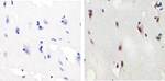 Phospho-SMAD2 (Ser465, Ser467) Antibody in Immunohistochemistry (Paraffin) (IHC (P))
