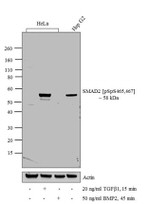 Phospho-SMAD2 (Ser465, Ser467) Antibody in Western Blot (WB)
