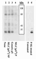 Phospho-MYLK (Ser19) Polyclonal Antibody
