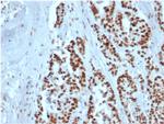 MSH2 Recombinant Mouse Monoclonal Antibody (rMSH2, 6548)