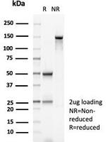 MSH2 (DNA Mismatch Repair Marker) Antibody in SDS-PAGE (SDS-PAGE)