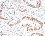 MSH2 (DNA Mismatch Repair Marker) Antibody in Immunohistochemistry (Paraffin) (IHC (P))
