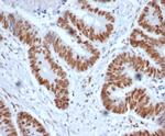 MSH2 (DNA Mismatch Repair Marker) Antibody in Immunohistochemistry (Paraffin) (IHC (P))