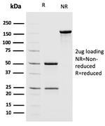 MSH2 Antibody in SDS-PAGE (SDS-PAGE)