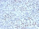 MSH2 (DNA Mismatch Repair Marker) Monoclonal Antibody (MSH2/3165)