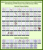 MSH2 (DNA Mismatch Repair Marker) Antibody in Immunohistochemistry (Paraffin) (IHC (P))