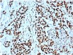 MSH2 Recombinant Rabbit Monoclonal Antibody (MSH2, 6549R)