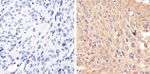 STAT2 Antibody in Immunohistochemistry (Paraffin) (IHC (P))