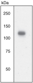 JAK2 Polyclonal Antibody