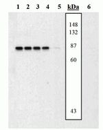 Phospho-MEK3/MEK6 (Ser189, Thr193, Ser207, Thr211) Polyclonal Antibody