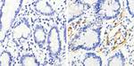 Phospho-HSP27 (Ser82) Antibody in Immunohistochemistry (Paraffin) (IHC (P))