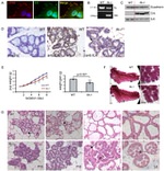 Phospho-FAK (Tyr397) Antibody in Immunohistochemistry (IHC)