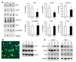 Phospho-FAK (Tyr397) Antibody in Western Blot (WB)