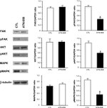 Phospho-FAK (Tyr397) Antibody in Western Blot (WB)