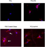 Phospho-FAK (Tyr397) Antibody in Immunocytochemistry (ICC/IF)