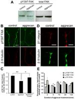 Phospho-FAK (Tyr397) Antibody in Western Blot, Immunohistochemistry (WB, IHC)