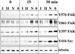 Phospho-FAK (Tyr397) Antibody in Western Blot (WB)