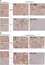Phospho-FAK (Tyr397) Antibody in Immunohistochemistry (Paraffin) (IHC (P))