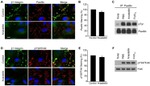 Phospho-FAK (Tyr397) Antibody in Western Blot, Immunocytochemistry (WB, ICC/IF)