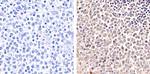 Phospho-PYK2 (Tyr579, Tyr580) Antibody in Immunohistochemistry (Paraffin) (IHC (P))