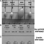 Phospho-SRC (Tyr419) Antibody in Western Blot (WB)
