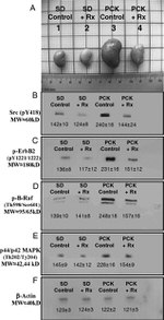 Phospho-SRC (Tyr419) Antibody in Western Blot (WB)