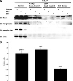 Phospho-SRC (Tyr419) Antibody in Western Blot (WB)
