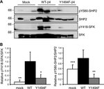 Phospho-SRC (Tyr419) Antibody in Western Blot (WB)