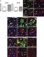 Phospho-SRC (Tyr419) Antibody in Immunohistochemistry (IHC)