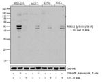 Phospho-JNK1/JNK2 (Thr183, Tyr185) Antibody in Western Blot (WB)